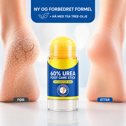 MykHæl™ | Når vanlig fotkrem ikke lenger fungerer