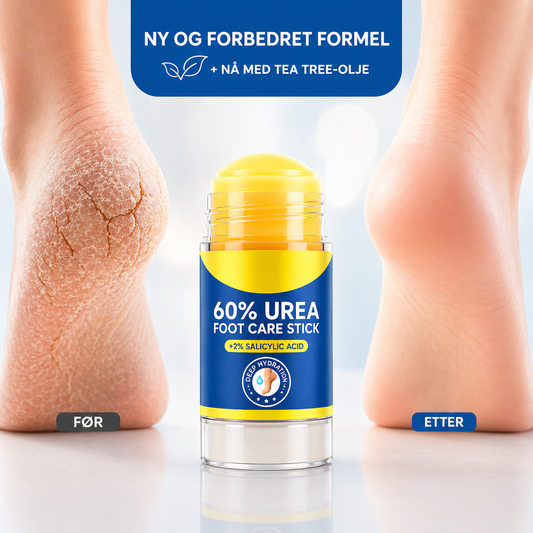 MykHæl™ | Når vanlig fotkrem ikke lenger fungerer
