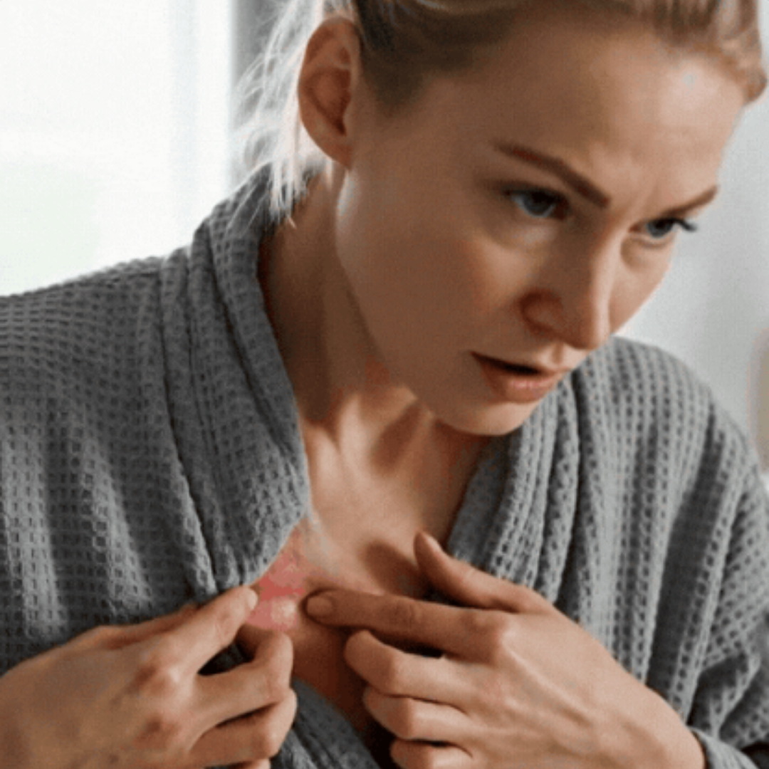 SkinRestore™ | Behandler 94% av hudirritasjon i hudfolder fra første bruk