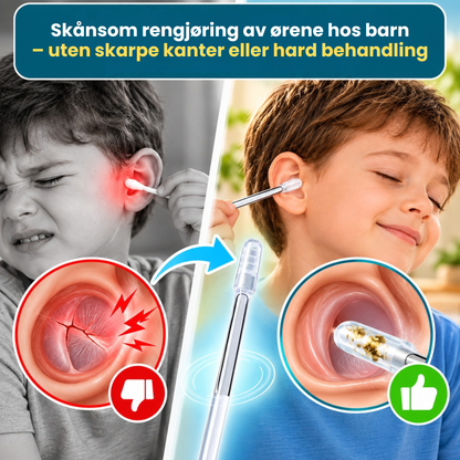EarCatch™ | Presis og skånsom rengjøring
