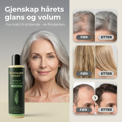 Rosemary Boost™ | Naturlig styrke, volum og pleie for håret ditt
