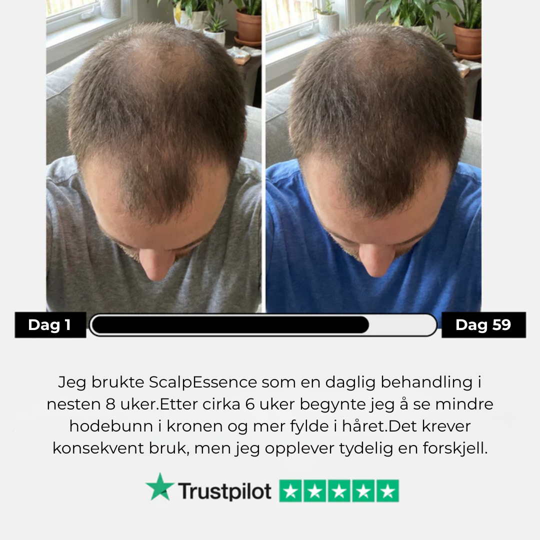 ScalpBoost™| Stimulerende hodebunnsbørste