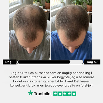 ScalpBoost™| Stimulerende hodebunnsbørste