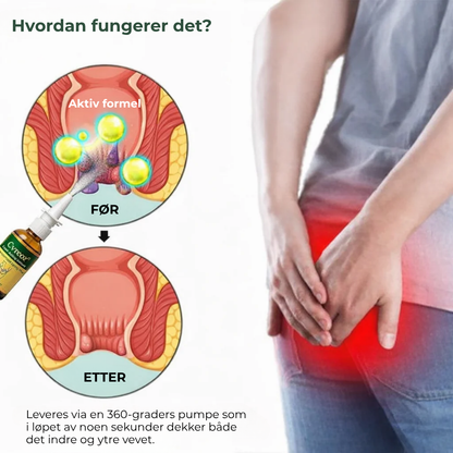 CalmEase™ | Hurtigvirkende, urtebasert spray mot hemoroider