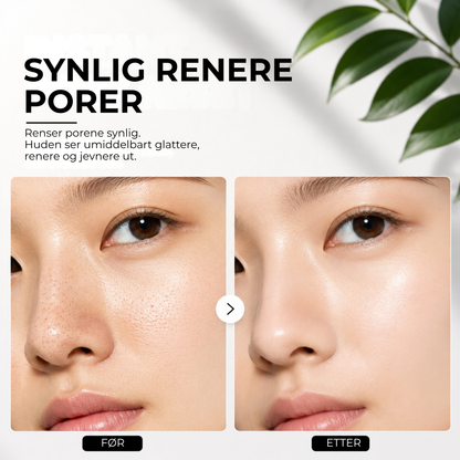 PorePure™ | Dyprens porene for en glattere hud