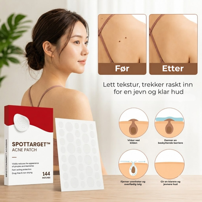 SpotTarget™ | Reduserer synlige hudutvekster, nupper og flekker på en målrettet måte.