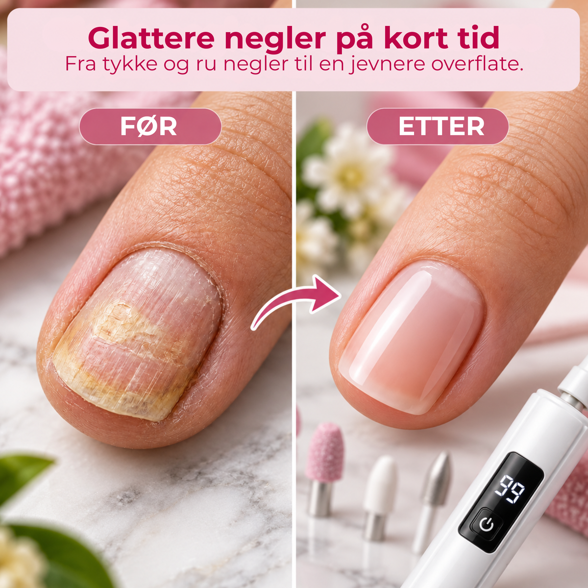 NegleStudio™ | Salongfølelse hjemme – uten tidkrevende håndfiling