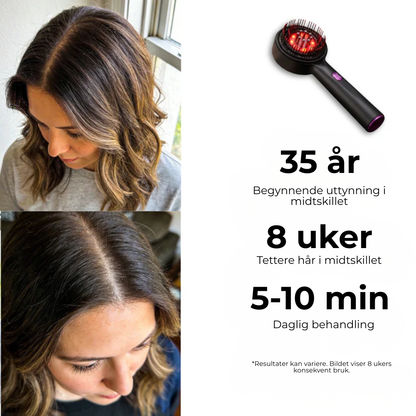 ScalpBoost™| Stimulerende hodebunnsbørste