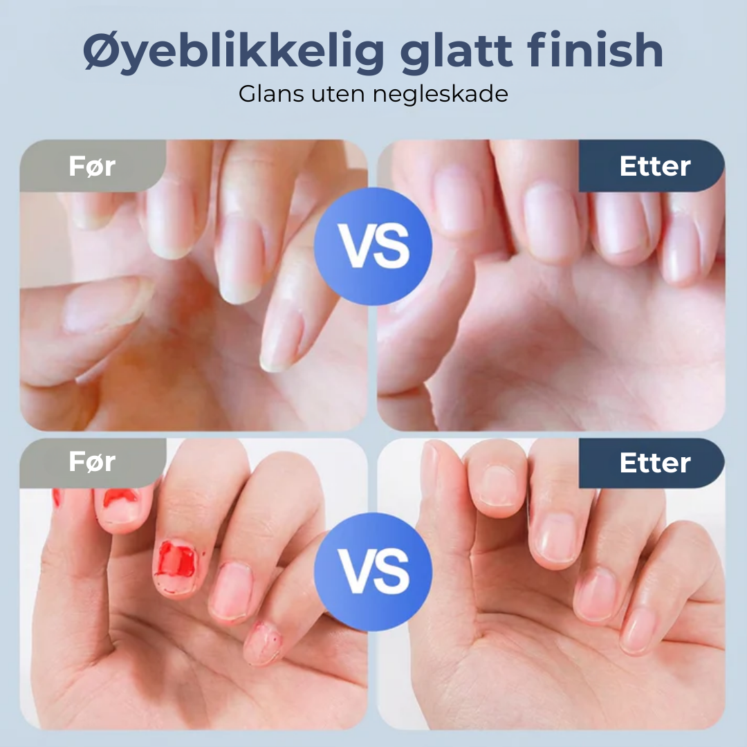 NegleRo™ | Trygg neglepleie – helt uten stress
