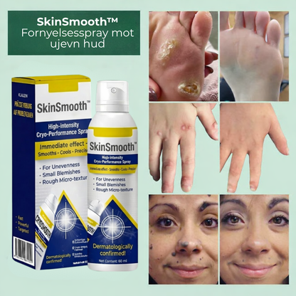 SkinSmooth™ | Presis kjølespray for glattere hud