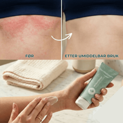 SkinRestore™ | Behandler 94% av hudirritasjon i hudfolder fra første bruk