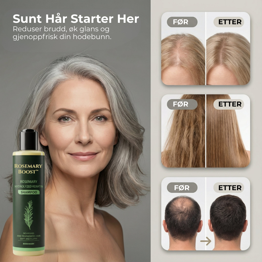 Rosemary Boost™ | Naturlig styrke, volum og pleie for håret ditt