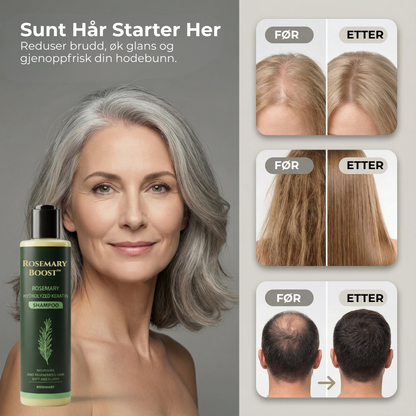 Rosemary Boost™ | Naturlig styrke, volum og pleie for håret ditt