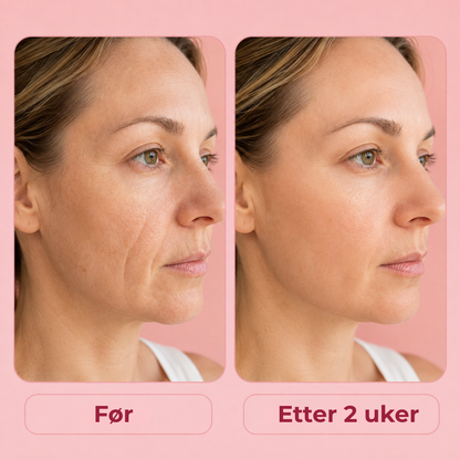 FaceRest™ | Færre putemerker, jevnere hud og bedre søvn