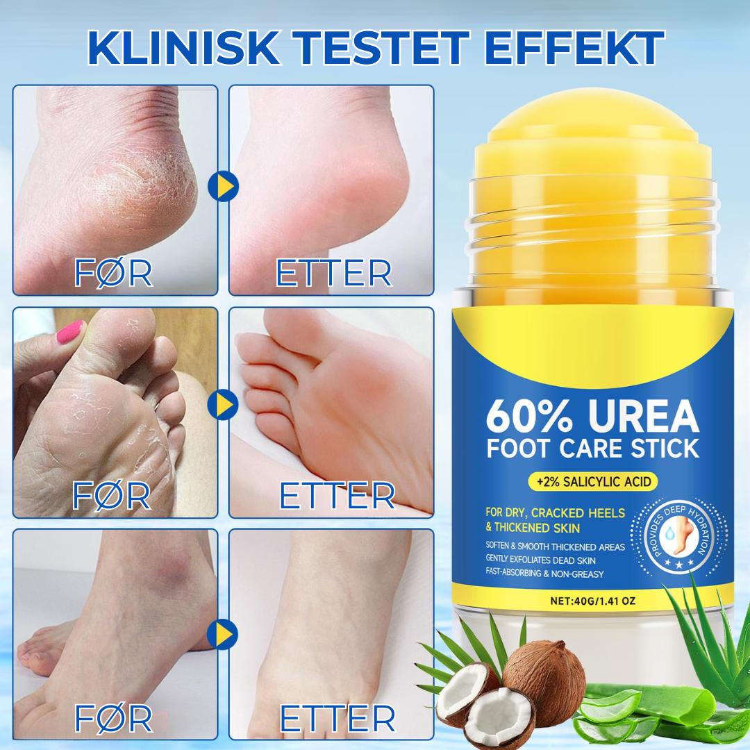 MykHæl™ | Når vanlig fotkrem ikke lenger fungerer