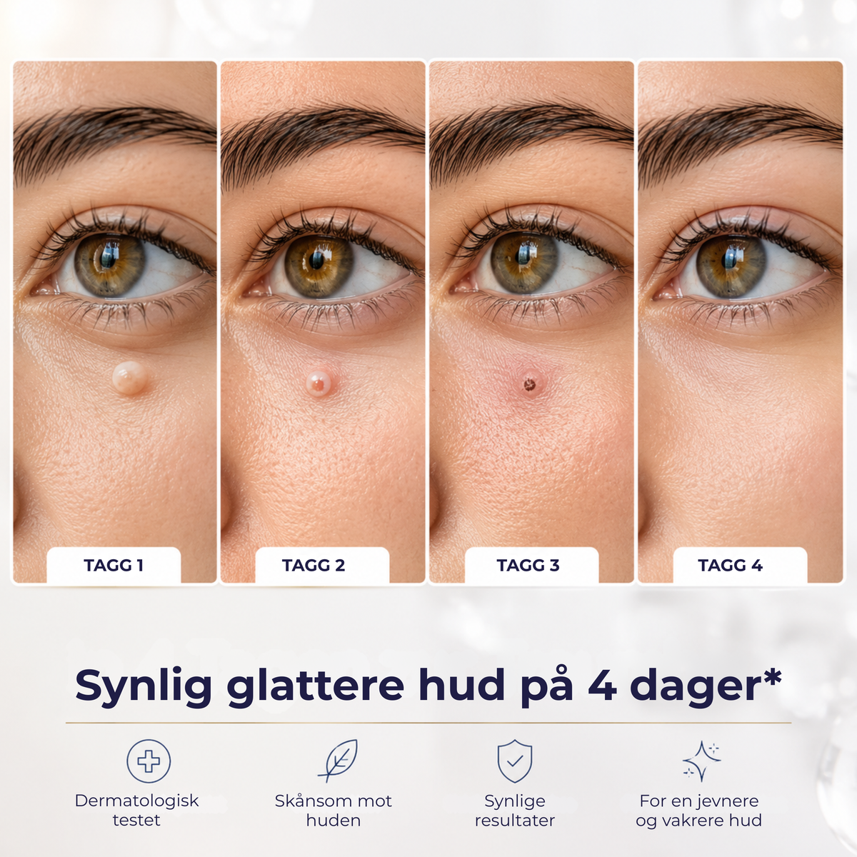 HudflikFjerner™ | Glatt hud på bare 4 dager