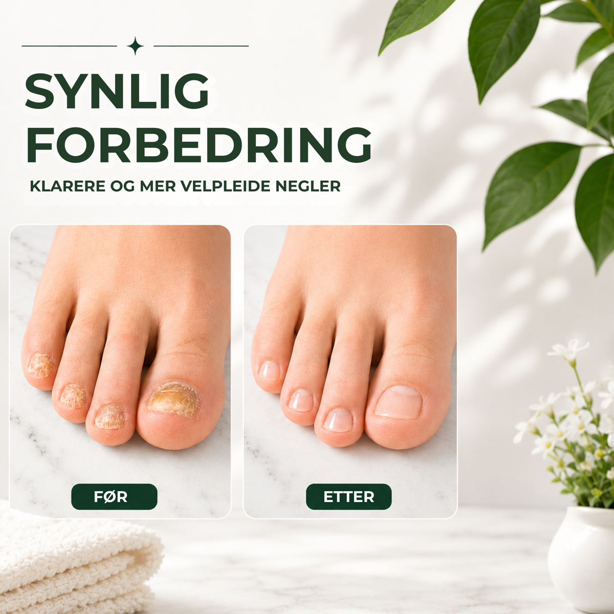 NeglePleie™ | Presisjonspenn mot neglesopp