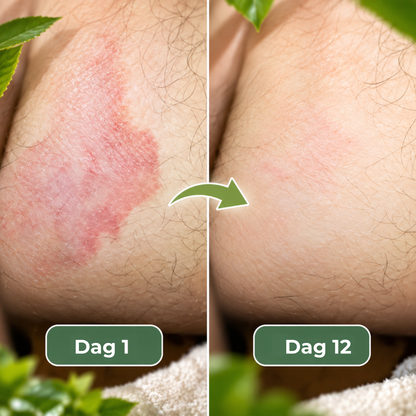 Terro™ | Målrettet pleie for områder utsatt for svette og fukt