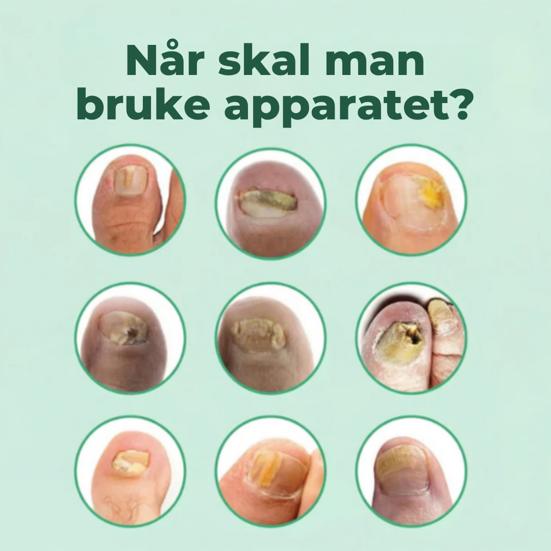 PureNail™ | Blått lys neglebehandlingsenhet