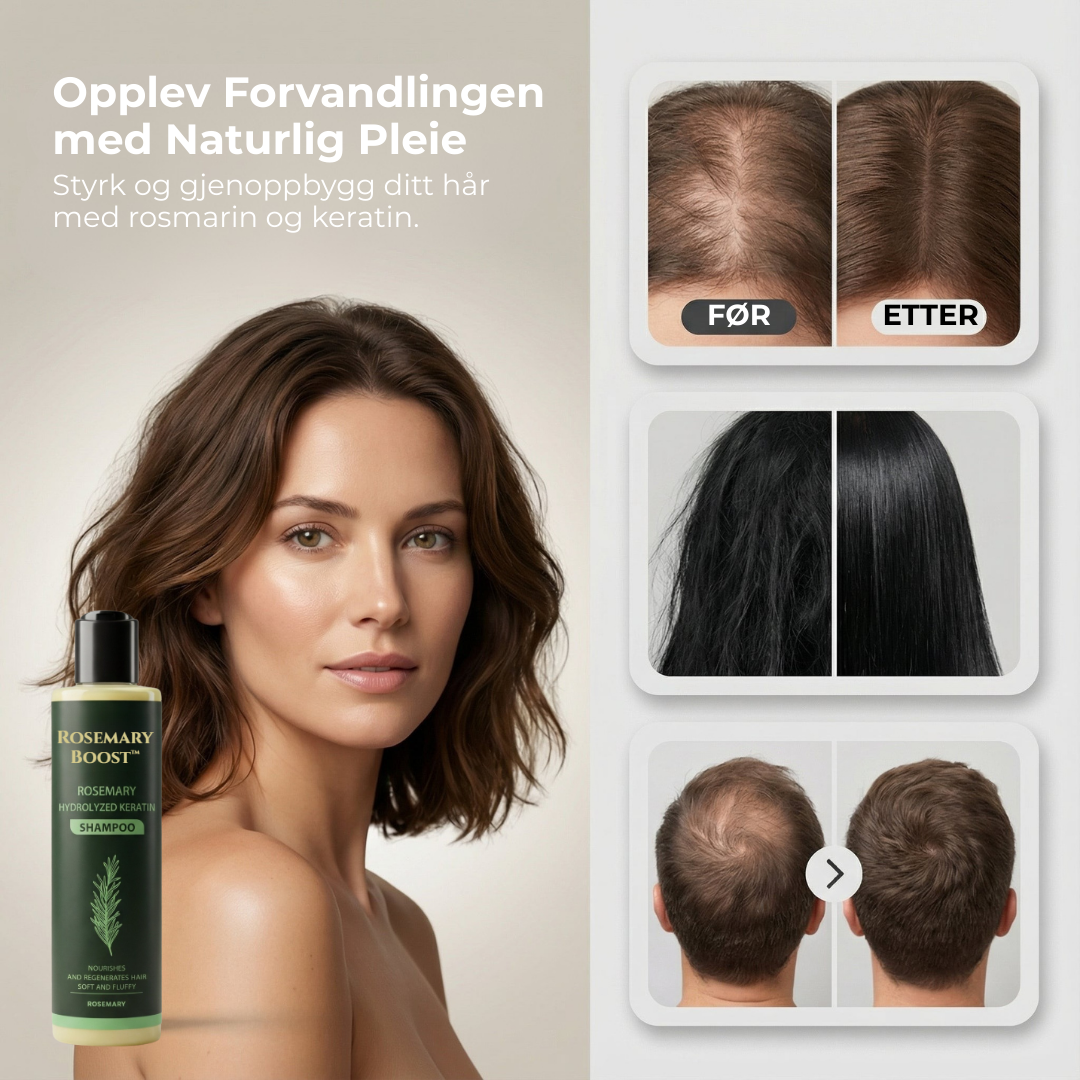 Rosemary Boost™ | Naturlig styrke, volum og pleie for håret ditt