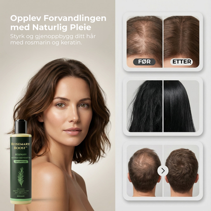 Rosemary Boost™ | Naturlig styrke, volum og pleie for håret ditt