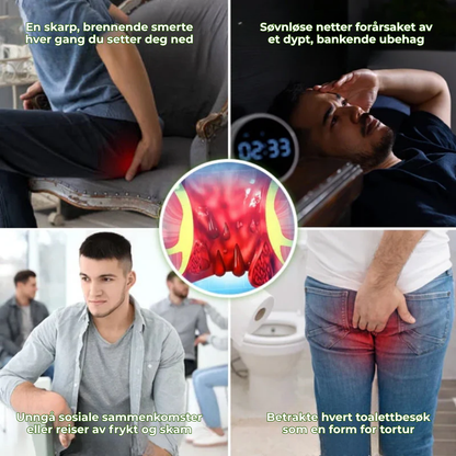 CalmEase™ | Hurtigvirkende, urtebasert spray mot hemoroider