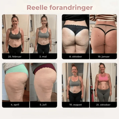 SculptWear™ | Leggings som jobber aktivt mot cellulitter