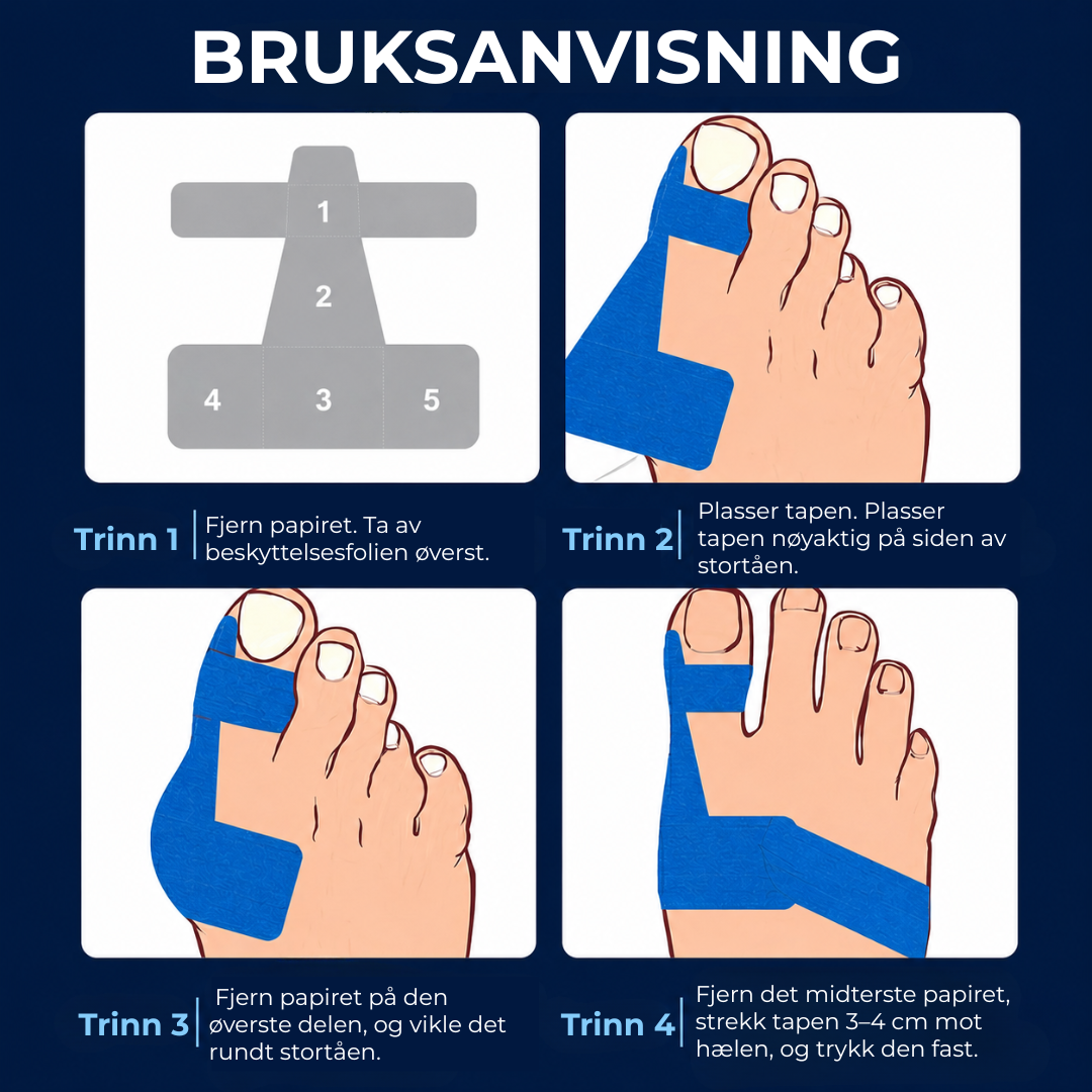 AlignTape™ | Ferdigklippet elastisk kinesiologitape for støtte ved hallux valgus