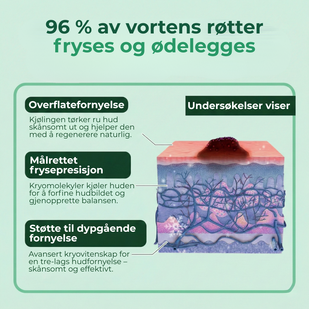 SkinSmooth™ | Presis kjølespray for glattere hud